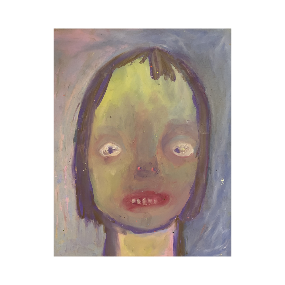 I Think I May Have a Concussion by Aditi De